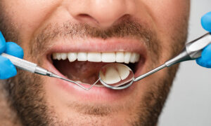 Healthy white male smile with a periodontal probe and mouth mirror, close-up. Teeth treatment. Shot part of the head
