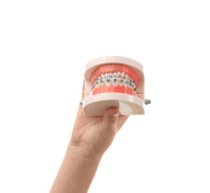 Child's hand holding jaw model with braces on white background