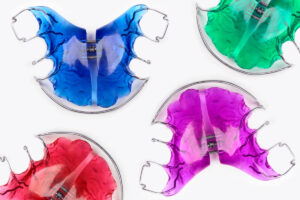 Close-up of children's orthodontic appliances in bright, fun colours on a white table. Concept of oral health in childhood.